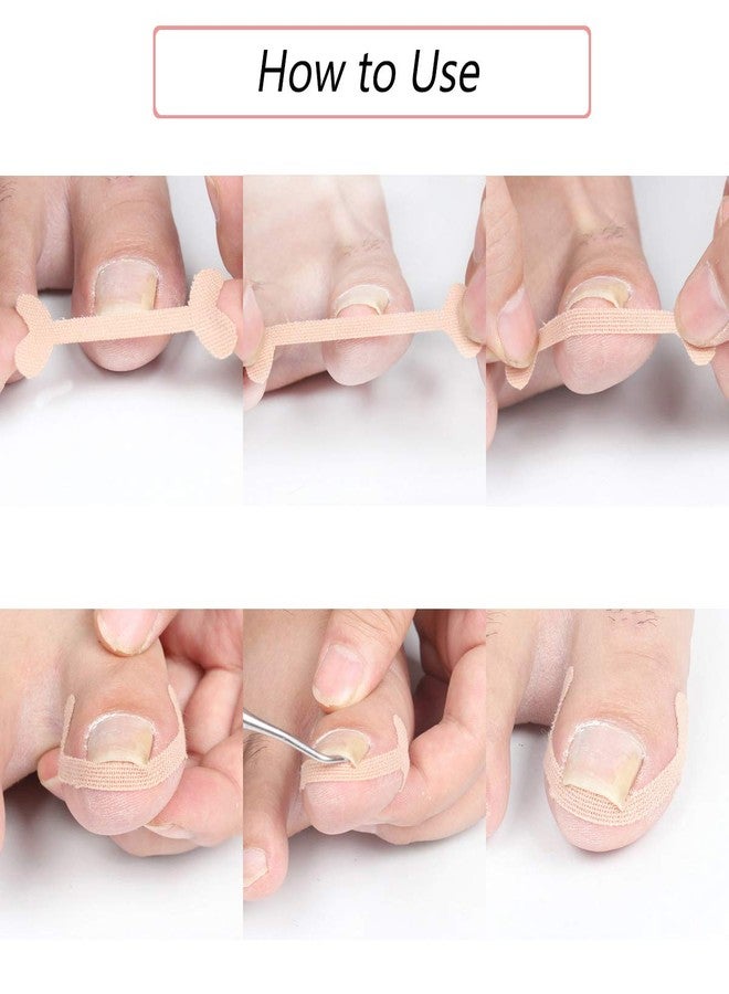 EBANKU Ingrown Toenail Treatment Strips, 20 Pcs Toe Nail Correction Patch Elastic Patch Sticker Corrector Pedicure Tools Fingernail Toe Nail Care - Image 5